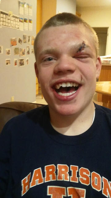 Three days after the incident.