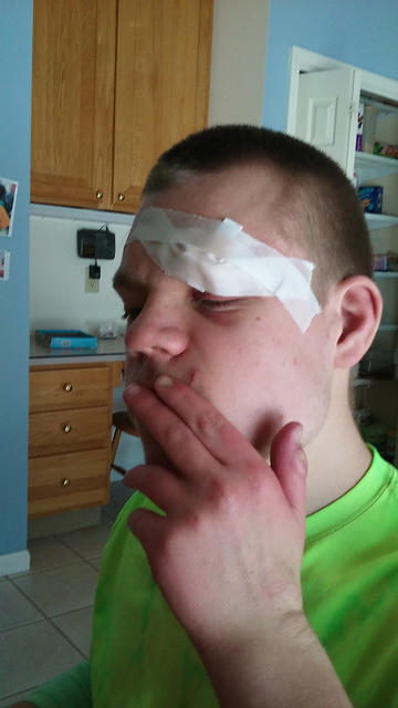 Being able to see out of only 1 eye doesn't seem to have affected his appetite any.